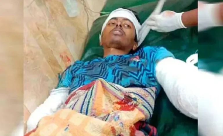 স্ত্রীর গোপন ভিডিও করায় সইতে না পেরে ভাইয়ের যে অঙ্গ কেটে দিলো